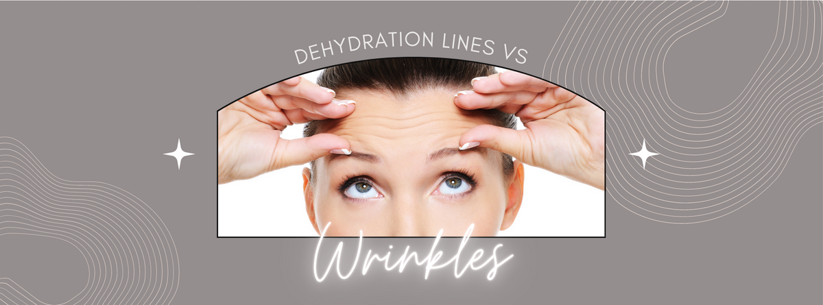 Dehydration Lines vs Wrinkles
